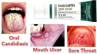 Miconazole Gel  ASMR Daktarin oral gel uses [upl. by Greyso]