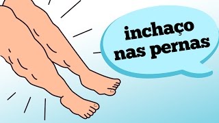 INCHAÇO NAS PERNAS O QUE PODE SER [upl. by Pentheas]