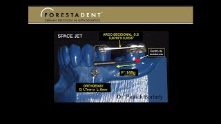 BIOMECÁNICA CON MINI IMPLANTES  7 MESIALIZACIÓN MOLAR CON SPACEJET DE FORESTADENT [upl. by Panaggio]