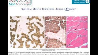 Introduction to Myopathies and Muscular Dystrophy [upl. by Feldstein434]