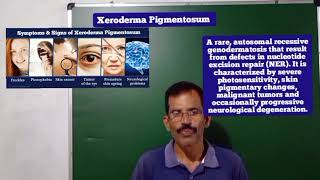 XERODERMA PIGMENTOSUM SAM BIOLOGY 🧫 CLASS [upl. by Noval286]