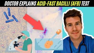 Doctor explains AcidFast Bacilli AFB test  Mycobacterium Tuberculosis TB [upl. by Nibroc]