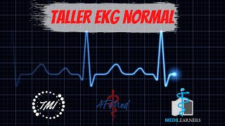 Taller Electrocardiograma Normal [upl. by Eatnohs612]