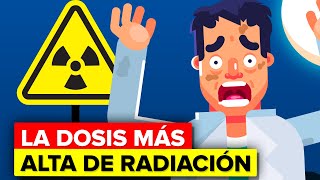 Hombre recibe la dosis más alta de radiación nuclear  Esto es lo que le pasó [upl. by Jone641]