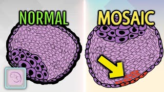 Successful IVF with mosaic embryo transfer [upl. by Liana]