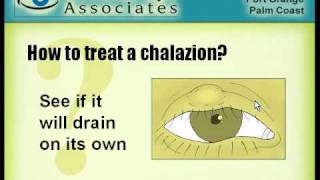 chalazion mpeg1at800600at7k [upl. by Assenay]