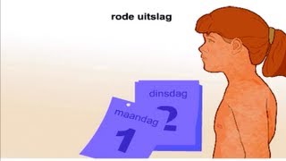 Rode hond  Symptomen en behandeling [upl. by Cassy]