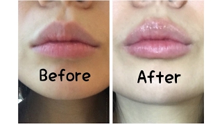 A lip plumper that actually works [upl. by Ahsirat]