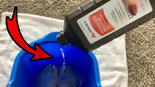 Put Hydrogen Peroxide on your FEET amp SEE WHAT HAPPENS 💥 this is cool and surprising [upl. by Ario356]