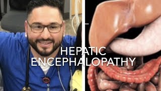 Hepatic Encephalopathy [upl. by Gnoht]