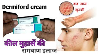 Dermiford cream full review benifitside effects amp usehindi [upl. by Roid]