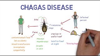 Chagas Disease  An overview [upl. by Aisatal274]