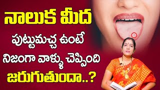 నాలుక మీద పుట్టుమచ్చల రహస్యం  Moles On Tongue Naluka Meda Machalu Unte Emoutundo Telusa [upl. by Topper552]