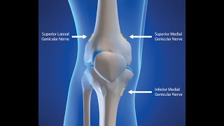 GENICULAR NERVE BLOCK [upl. by Ciapha]