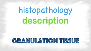 Granulation Tissue  Histopathology [upl. by Mackay]