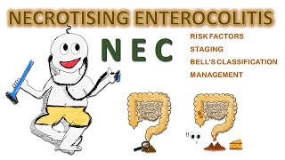 NEC  Necrotizing enterocolitis NEONATOLOGY SERIES CH6 [upl. by Harleigh]