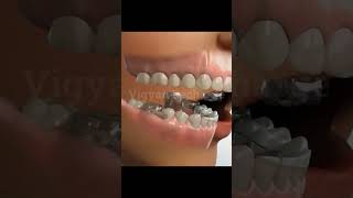 Jaw Treatment teeth dentist health [upl. by Ydnic]