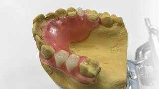 How To Make A Fiber Flex™ Partial  The Entire Process  Dental Lab Learning [upl. by Pet477]