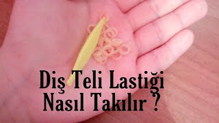 Diş Teli Lastiği Nasıl TakılırampDiş Teli Varken Dişleri Nasıl FırçalamalıyızampGÜNLÜK VLOG AKŞAM RUTİNİ [upl. by Gemmell]