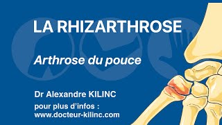 Rhizarthrose ou Arthrose du pouce explications du Dr Kilinc [upl. by Garnett]