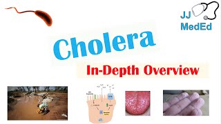 Vibrio Cholerae Causes Symptoms Prevention and Diagnosis neet garimagoel vibrio cholerae [upl. by Adelaide668]