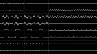 Sonic Advance 3  Nonaggression Pinch oscilloscope view [upl. by Nileak]