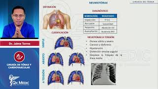 Neumotórax de trauma torácico de cirugía de tórax y CV QxMedic 2024 [upl. by Lavicrep]