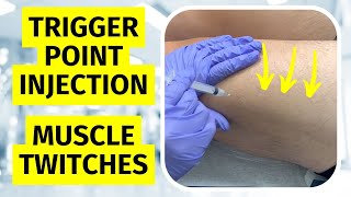 Trigger Point Injection Twitches  Dry Needling Twitch Response [upl. by Heidi]