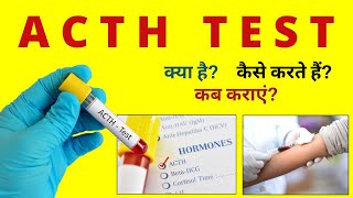 ACTH Test in Hindi  ACTH Test Procedure Preparation  Explained in Hindi [upl. by Yesiad]