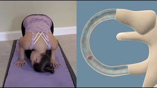 Half Somersault Maneuver to Treat BPPV Vertigo [upl. by Prudence191]