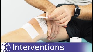 McConnell Taping for PFPS  Patellofemoral Pain Syndrome [upl. by Nerraj]