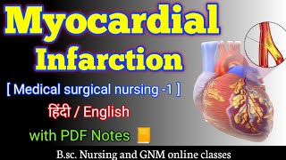 Myocardial infarction  Myocardial infarction in hindi  Myocardial infarction msn  bsc nursing 2nd [upl. by Naashom]