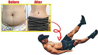 Your belly has a lot of excess fat  Try these abdominal exercises now [upl. by Leiruh]