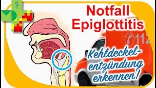 Epiglottitis  Kehldeckelentzündung erkennen und richtig reagieren [upl. by Enyedy859]