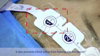 Disposable noninvasive EEG Sensor [upl. by Hpeosj]