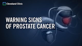 10 Warning Signs of Prostate Cancer [upl. by Eiuqcaj]