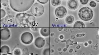 Blastocystis  Wikipedia audio article [upl. by Ladonna828]