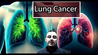 Lung Cancer From the Deadliest to the Least Aggressive Forms [upl. by Ahsienod]