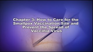 Chapter 3 How to Care for the Smallpox Vaccination Site and Prevent the Spread of Vaccinia Virus [upl. by Stanley]