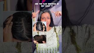 Tips for Oily Irritated Scalp  Itchy Oily Scalp haircare [upl. by Rape523]