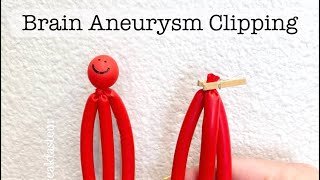 Playdough Surgery 🔪🧠🍒  Brain Aneurysm Clipping [upl. by Noel867]