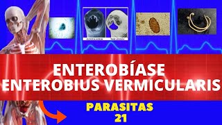 ENTEROBÍASE  ENTEROBIUS VERMICULARIS OXIURÍASE  PARASITOLOGIA INFECTOLOGIA [upl. by Supen]