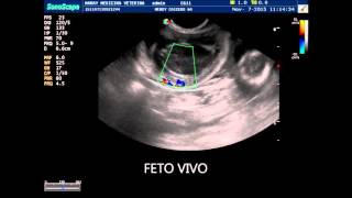 FETOS VIVOS Y FETO MUERTO DIFERENCIAS ECOGRAFICAS [upl. by Jarret708]