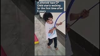 IMPROVEMENT OF ATHETOID CEREBRAL PALSY After 3 months of Tharapyyoutubeshorts cerebralpalsy [upl. by Airak]