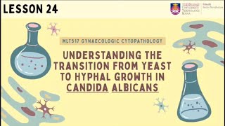 Understanding The Transition From Yeast To Hyphal Growth In Candida Albicans [upl. by Akienom]