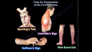 Cervical Spine Exam Myotomes [upl. by Nytsirhc]