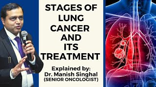 Stages of Lung Cancer amp Its Treatment  Explained by Dr Manish Singhal Sr Oncologist [upl. by Shakespeare]