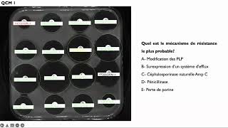 Lecture interprétative de l’antibiogramme de Pseudomonas aeruginosa [upl. by Arocet]