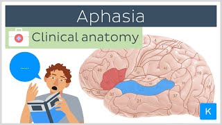 Aphasia Wernickes vs Brocas  Clinical Anatomy  Kenhub [upl. by Suruat977]