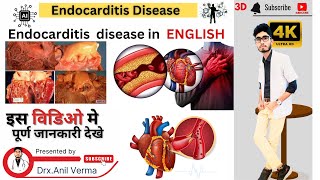 What is Endocarditis Disease 🤔 Endocarditis Disease Causes Symptoms And Treatment  MSN  MBBS [upl. by Bolme170]